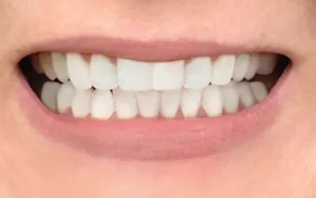 Close-up of a smiling mouth