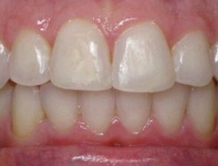 Close-up of human teeth